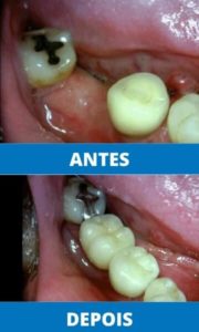 unit-clinica-odontologica-endereco-rua-antonio-ataide-849-ed-rafaela-lj-05-centro-vila-velha-telefone-27-998772036-ponte-fixa