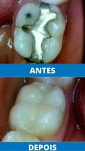 unit-clinica-odontologica-endereco-rua-antonio-ataide-849-ed-rafaela-lj-05-centro-vila-velha-telefone-27-998772036-sbustituicao-de-metais